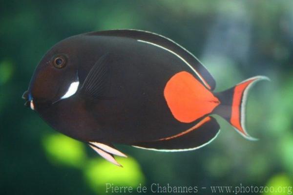 Achilles tang